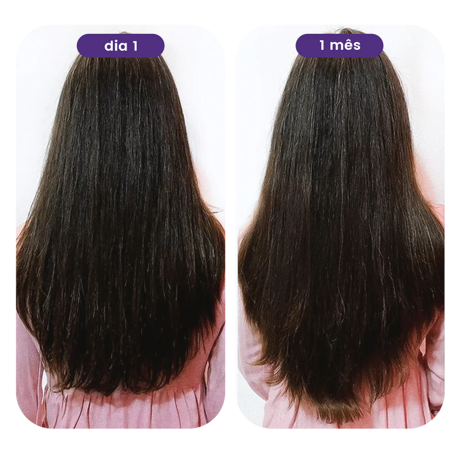 Antes e depois 1 mês