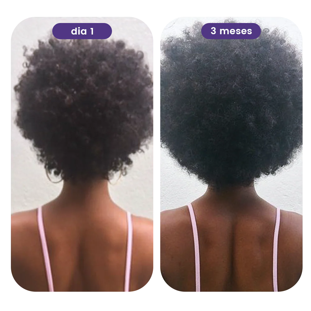 Antes e depois 3 meses